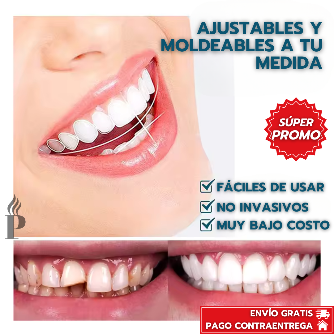 SnapOn Fix Smile™: Carillas Dentales Ajustables - Dientes de Cerámica